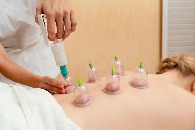 Therapeutic cupping and myofascial decompression treatment at Root Therapy and Wellness in Bozeman, MT